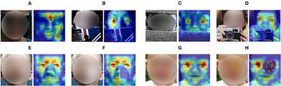 TFE: A Transformer Architecture for Occlusion Aware Facial Expression Recognition